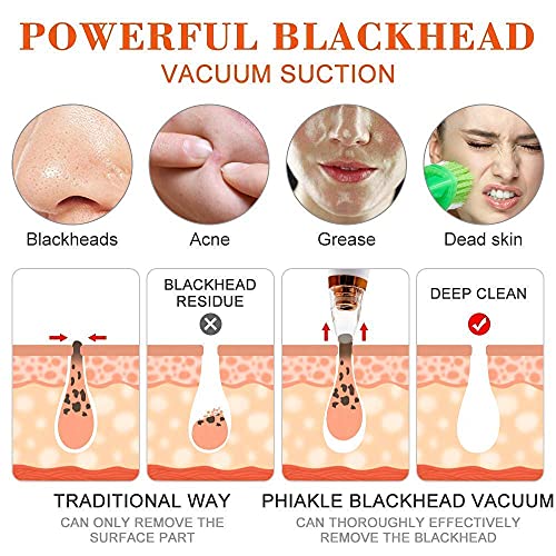 Image of Multi-function Blackhead Remover Tools | Electric Derma suction Machine | USB Rechargeable Acne Pimple Pore Cleaner Vacuum tool | Facial Cleanser Device for Nose & Skin Care (6in 1 Red)
