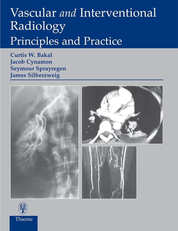 Vascular and Interventional Radiology: Principles and Practice (English Edition)