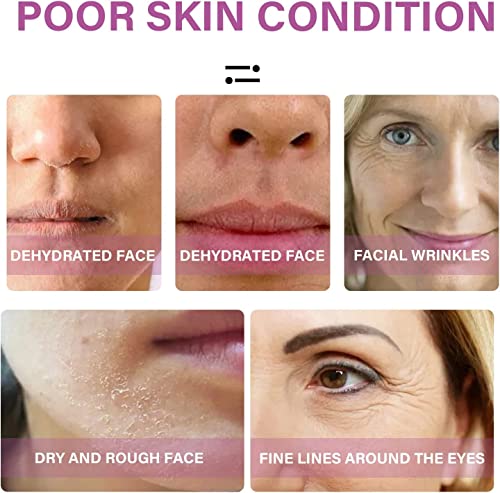 Be Youth Procollagen And Ceramide Lifting Ampoule Serum, Beyouth Pro-Collagen And Ceramide Lifting Ampoule Serum, Anti-Wrinkle And Anti-Aging Be Youth Pro Collagen Serum For Face (35 Bottles) #TOP6