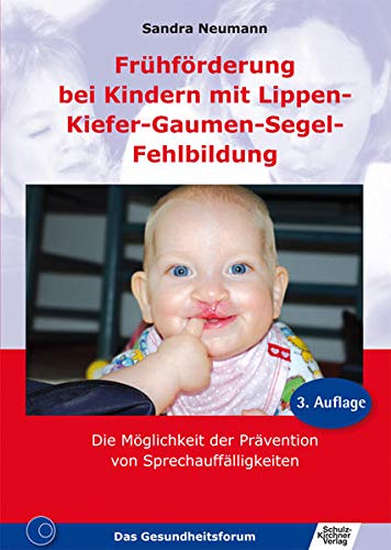 Frühförderung bei Kindern mit Lippen-Kiefer-Gaumen-Segel-Fehlbildung: Die Möglichkeit der Präven Frühförderung bei Kindern mit Lippen-Kiefer-Gaumen-Segel-Fehlbildung: Die Möglichkeit der Präven