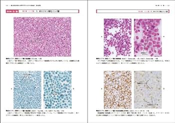 改訂新版 臨床検査技師を目指す学生のための細胞診 | 土屋 眞一, 金子