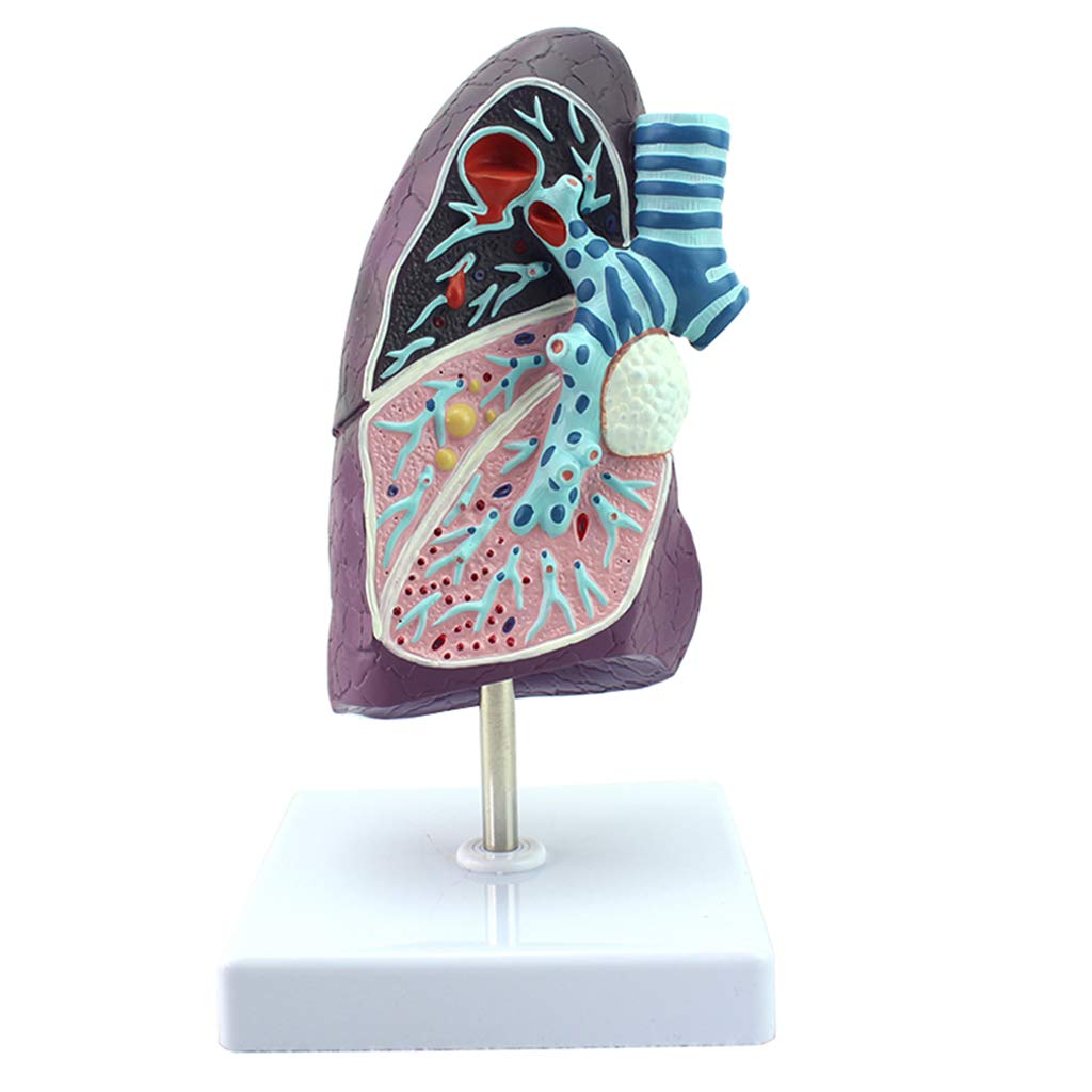 Sjdopulse Black Lung Anatomical Model - Human Organ Anatomy Model - Smoker's Pathological Tuberculosis Pneumonia Thoracic Surgery Respiratory Model - Human Anatomy Science Models
