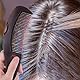 2 Stück Läusekamm Schuppenkamm Dandruff Comb Rostfreier Stahl Flohkamm Stainless Steel Fine Tooth Comb Läusekamm mit Silikongriff für Pflegen und Entfernen von Schuppen Oder LäusenLäuse