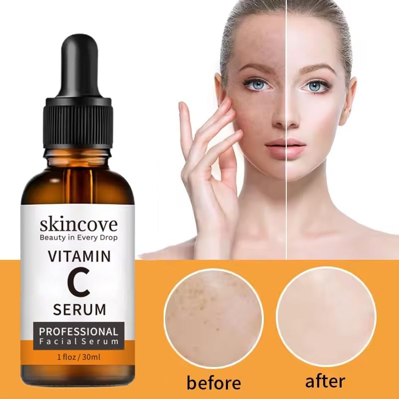 Miniatura 5 de Skincove Suero de vitamina C  Suero facial antienvejecimiento con vitamina C, ácido hialurónico, vitamina E  Suero iluminador  tono de piel