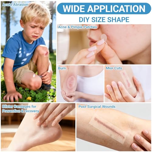 Image of Hydrocolloid Roll, Hydrocolloid Tape Roll for Skin Protection, Ideal for Daily Skincare and Wound Care Management, Water-Resistant Adhesive Bandage for Skin Types
