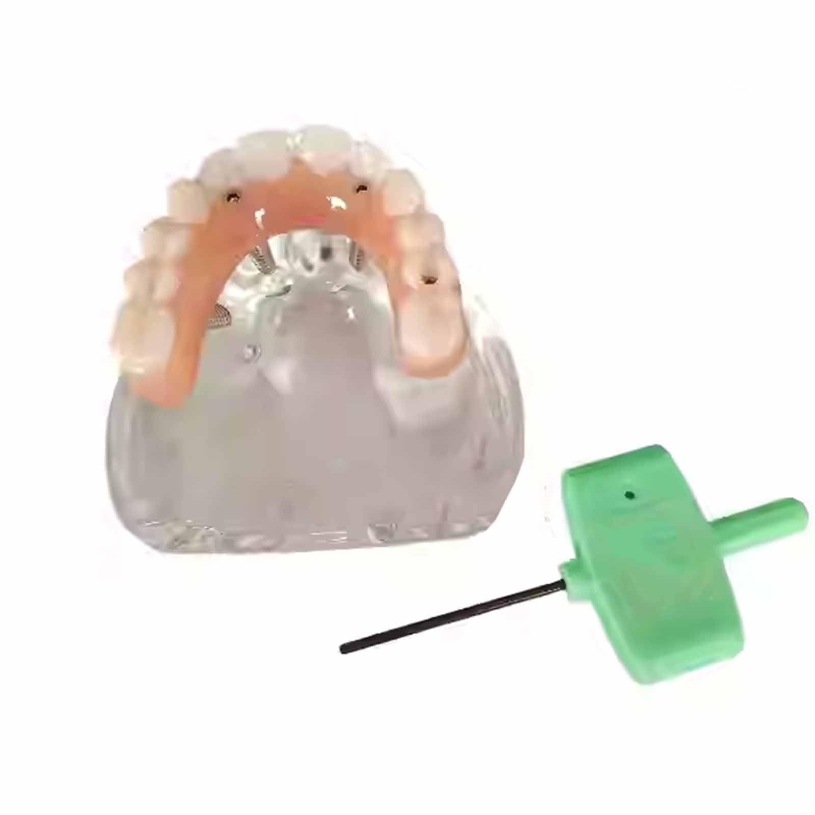 Modèle d'overdenture Modèle de typodont Dentaire Modèle d'implant pour la Recherche, l'enseignement et l'étude en médecine Dentaire