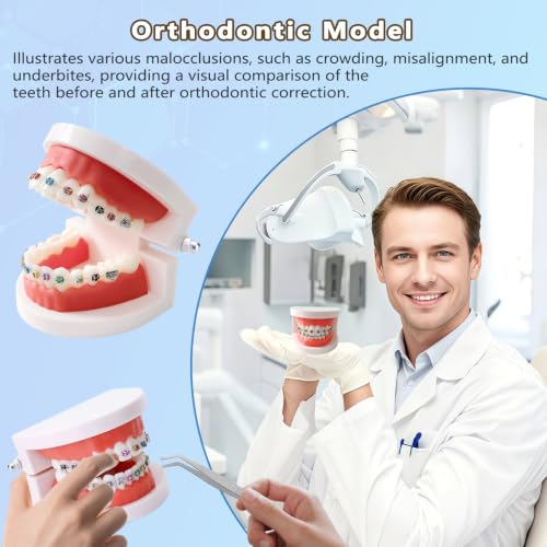 Image of 1 Pack Dental Orthodontic Teeth Model with Colorful Braces,Dental Training,Teaching,Practice,Professional Denture Mouth Model Demonstration Study Tool for Dentistry and Orthodontists