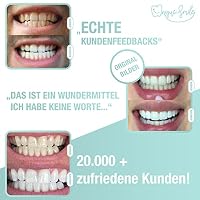 Hochwertiges Teeth whitening kit von UniqueSmile - All in One Bundle für Zahnaufhellung & weiße Zähne|Zahn Bleaching Set (Nachfüll-Set) – Ansicht 2