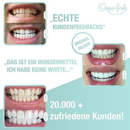 Bleaching Set UniqueSmile Hochwertiges Teeth Whitening Kit