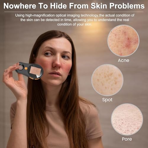Dermatoscope - Microscopio digitale 500X per la cura del cuoio capelluto e della pelle, lente d'ingrandimento portatile per un facile utilizzo e analisi