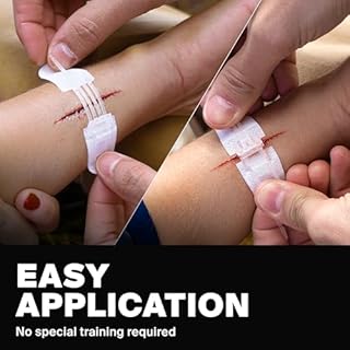 SurviveX Zip Stitch Wound Closure Strips - Repair Wounds Without Stitches - Zipstitch Sutures - Laceration Closure First Aid Kit