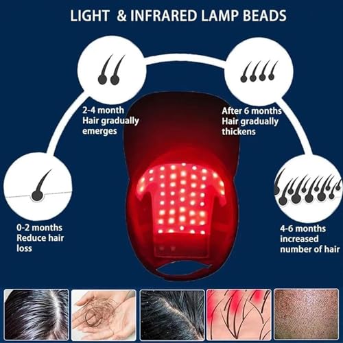 Casque LED thérapie à la lumière rouge GAOXIAO repousse et densité - 3