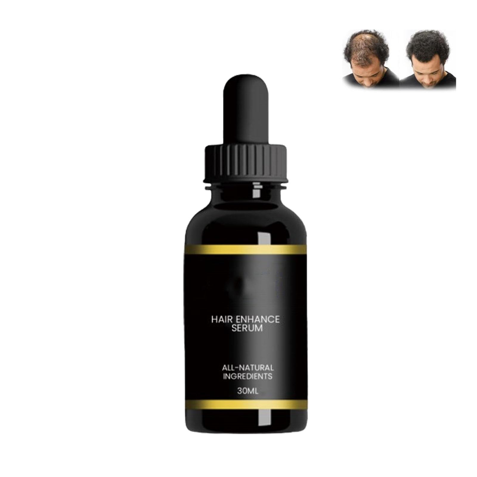 Folix22 Hair Growth Formula, Folix22 Hair Growth Serum, Folix22 Hair Growth Oil, Folix 22 Hair Loss Formula, Folix 22 Hair Growth Solution, Folix22 Hair Growth System, Hair Growth Products (1pcs)