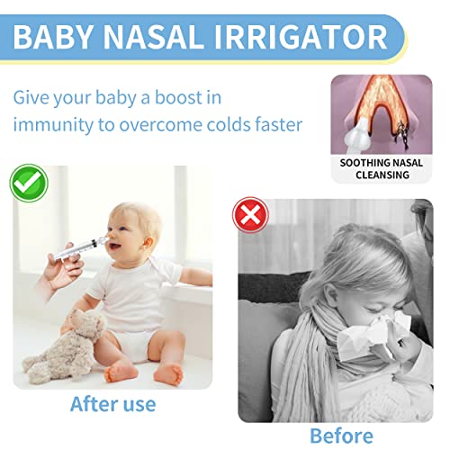 Aufisi Nasenspritze Baby, 2 Stück Nasenspüler Wiederverwendbare, Nasendusche Kinder 10ml Tragbares, Nasenspülung mit Silikon Nasensaugspitze, Hochwertigen Nasenspülset Sicherer und Komfortabel
