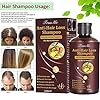 Hair-Growth-Shampoo-Hair-Loss-Shampoo-Hair-Thickening-Shampoo-Helps-Stop-Hair-Loss-Grow-Hair-Fast-Hair-Loss-Treatment-for-Men-Women-220mL Hair Growth Shampoo, Hair Loss Shampoo, Hair Thickening Shampoo, Anti-Thinning Shampoo, Hair Growth-Thickening Shampoo, Hair Loss Treatment, for Stop Hair Loss, Grow Hair Fast, Men & Women, 220ML