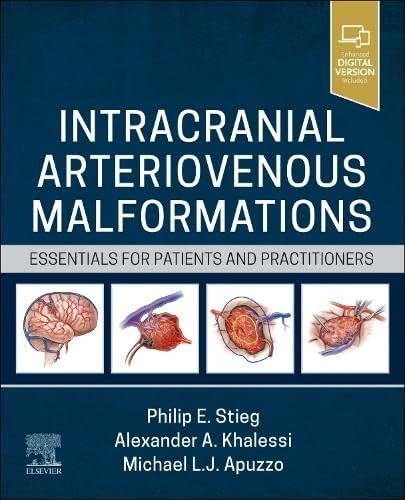 Buy Intracranial Arteriovenous Malformations: Essentials for Patients and Practitioners — BookShops.in