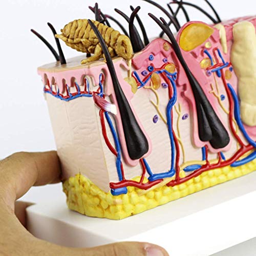 Skin Model Mites Bites Human Skin Anatomical Model Skin Irritation Water Pustule Anatomy for Science Classroom Study Display Teaching Medical Model