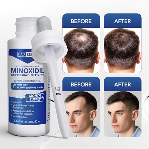 Hair Regen Liquid Minoxidil for Men 5% – Advanced Topical Solution for Regrowth – Growth Treatment for Men Hair Loss 6-Pack as 6-Month Supply Kit