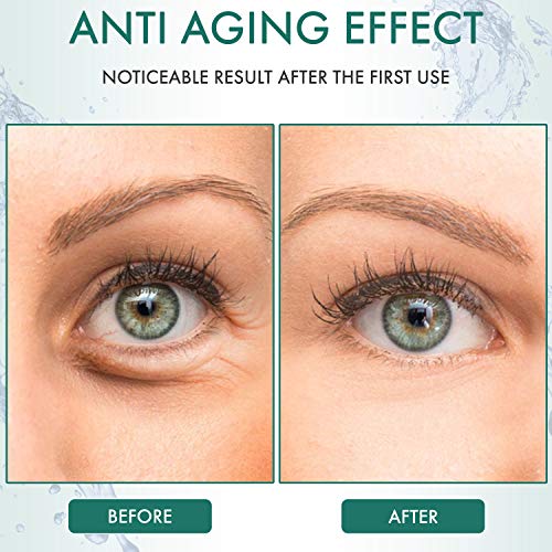 Mashele Korean Under Eye Patches Aloe Vera Mask Anti-Aging Hyaluronic Acid Collagen Neck Forehead Laugh Line Pad Reducing Dark Circles Treatment (120Pcs, Aloe Eye Patches) #TOP7