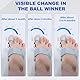 DGMI Verstellbare Hallux Valgus Schiene,Hallux Valgus Korrektur,Hallux Valgus Korrektur Set,Reduziert Hallux Valgus Belastung für Männer und Frauen