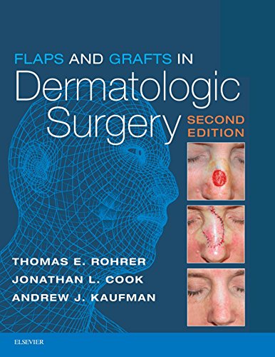 Flaps and Grafts in Dermatologic Surgery E-Book: Text with DVD