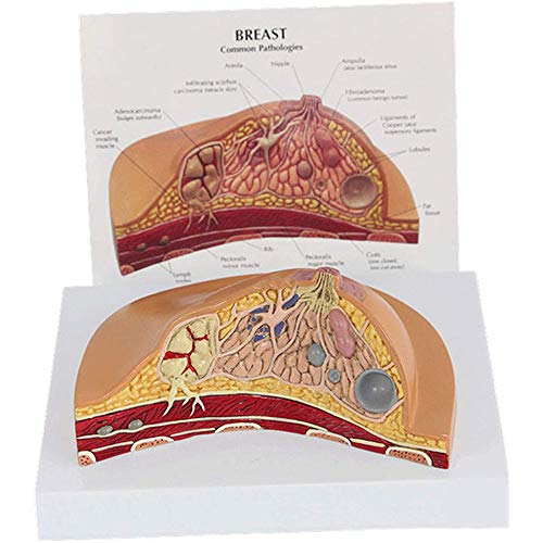 Modèle anatomique de lésion mammaire pour décoder la recherche médicale - 2