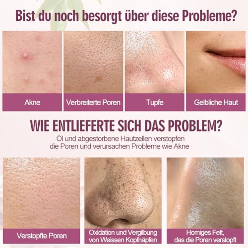 2 botellas AHA 30% + BHA 2% Peeling Solution, sérum facial exfoliante, hidratante antiedad para poros claros, líneas finas y piel radiante - imagen 2