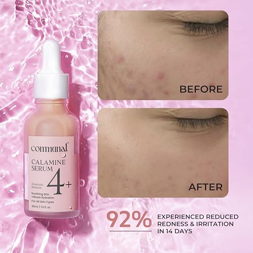 Image of Communal Calamine 4% Face Serum 30ml with Allantoin & Betaine | Soothing Oil Control Face Serum for Oily, Acne-Prone & Sensitive Skin | Pore Minimizing, Hydrating & Redness Calming Formula