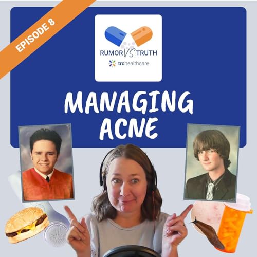Managing Acne