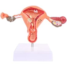 Human Uterine Ovarian Pathological Lesion Models Medical Teaching Anatomy Model