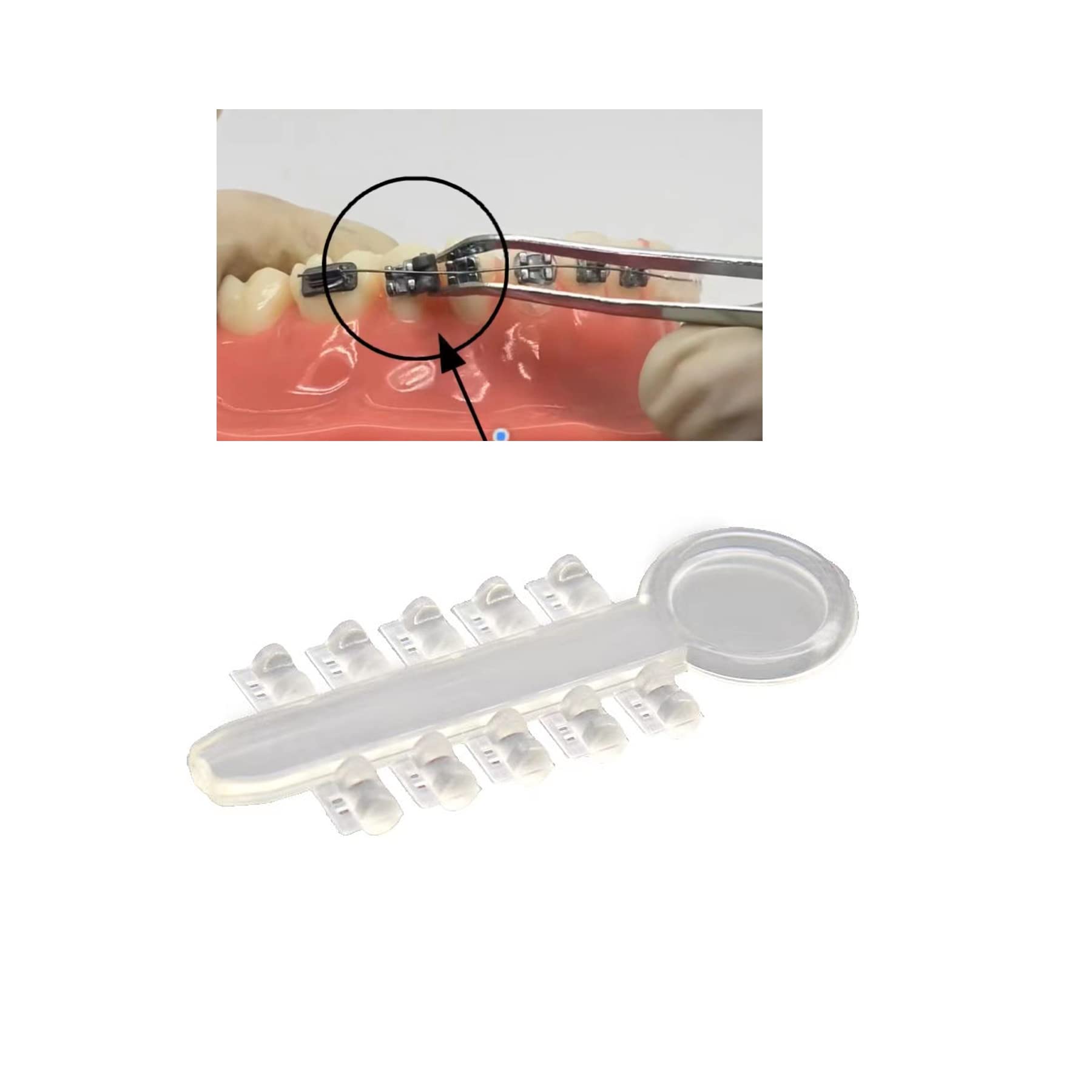 200pcs Orthodontic Rotation Wedges Elastic Rubber Bands Ligature Rotary Torsion Pad Clear