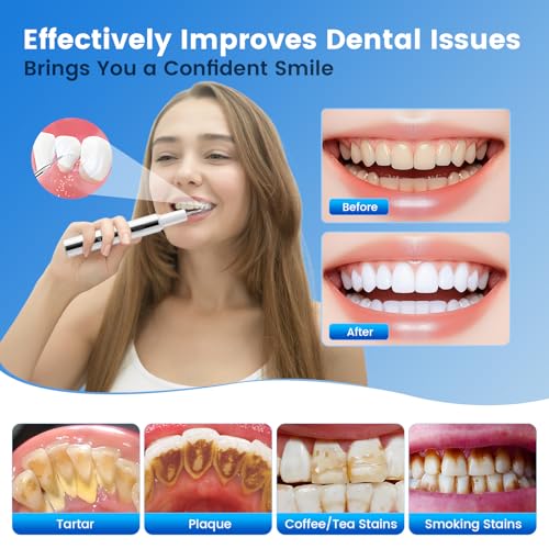 Torvex Teeth Plaque Remover, For Tartar & Plaque Removal, Suitable For Home Teeth Care And Cat & Dog Teeth Cleaning Product, Equipped With 5 Cleaning Modes & Led Lighting (White) - 4
