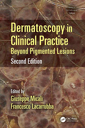 Dermatoscopy in Clinical Practice: Beyond Pigmented Lesions (Series in Dermatological Treatment)