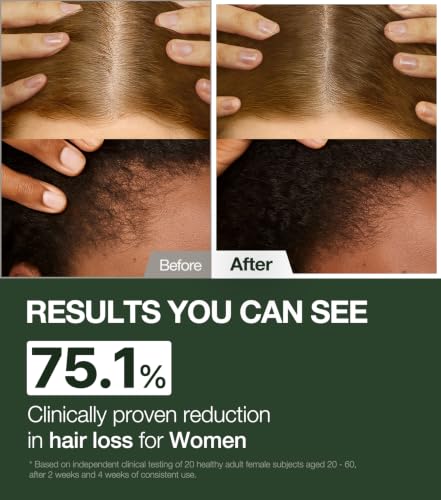 Alpha Erguen Hair Loss Shampoo for Women, Vegan Scalp Care Shampoo for Thinning Hair, Weak Hair & Hair Shedding, Pregnancy Safe Formula & Postpartum Hair Care, 500ml / 16.9 fl oz - Image 3