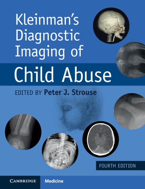Kleinman's Diagnostic Imaging of Child Abuse (English Edition)