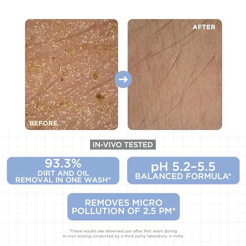 Image of SKINQ Niacinamide Face Wash | Gentle Daily Cleanser with Evening Primrose Oil & Glycerin | pH Balanced 5.2-5.5 | Dirt & Oil Removal in 1 Wash | No SLS, No Parabens | For Normal, Dry & Sensitive Skin | 100ml