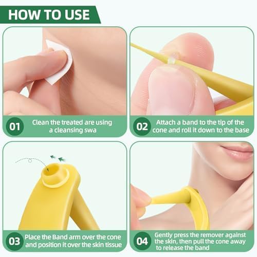 Miniatura 4 de Eliminador de marcas de piel, dispositivo de eliminación de marcas cutáneas aprobado por la FDA para uso doméstico
