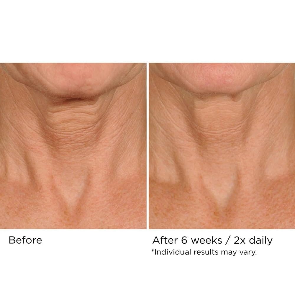 NassifMD Deco-Lift Neck Firming Complex Serum