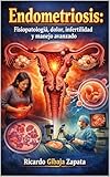 dolores ombrage mort  Endometriosis fisiopatología, dolor, infertilidad y manejo avanzado (Spanish Edition)