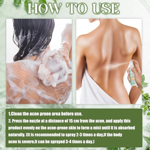 Akne Rücken Spray, Akne Komplex Spray, Back Acne Treatment, Rücken-Peeling Tiefenreinigung, Behandlung von Rückenakne, Natürlich, sanft zur Haut