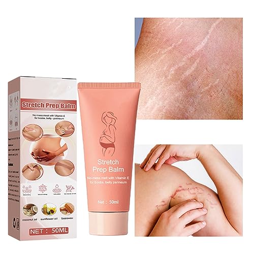 Creme para Estrias de Gravidez, Creme Suave para Estrias, Massagem Portátil, 50ml, Hidratação Segura