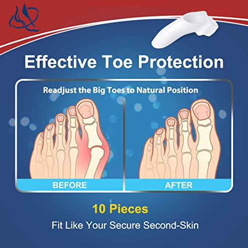 Bunion Corrector For Women Men, Toe Separators For Women, Toe Spacers For Bunion Relief (2 Loops), Bunion Pads With Gel Shield, Bunion Cushion Protector For Hammer Toes, Friction, Calluses, 10 Packs #TOP3