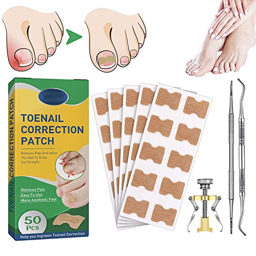 Treatment Ingrown Toenail Corrector Strips,Fitmedify Nail Patches with Nail Correction Tool Kit,Toenail Correction Patch,Ingrown Toenail Removal Kit