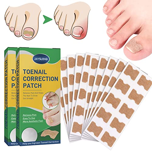 100PCS Toenail Corrector Patch, Ingrown Toenail Corrector Strips, Health Toenail Corrector Patch, Painless Pedicure Toenail Corrector Patch, With Nail Correction Tool