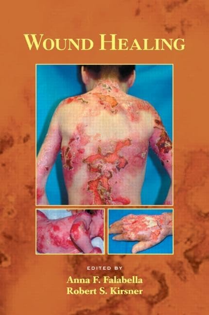 Wound Healing: 34 (Basic and Clinical Dermatology)