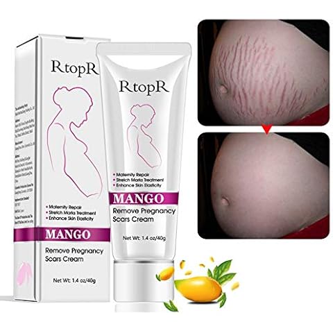 Reddhoon 2 Pack Mango Stretch Marks Scar Cream, Stretch Marks Treatment, Maternity Repair, Recovery Elasticity, Repair Scar Slack Line Abdomen Stretch Marks Postpartum Cover