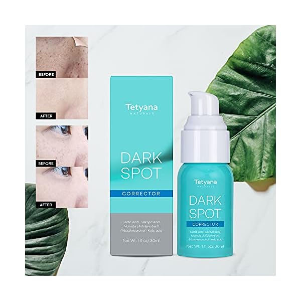 Tetyana-Dark-Spot-Corrector-For-Face-and-Body-Armpit-Knees-Elbows-Private-Areas-Instant-Result Tetyana Dark Spot Corrector For Face and Body-Armpit, Knees, Elbows, Private Areas, Instant Result