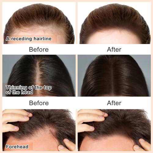 Boobeen Hairline Powder Stick - Waterproof Concealer for Thinning Hair, Graying Roots and Hair Loss