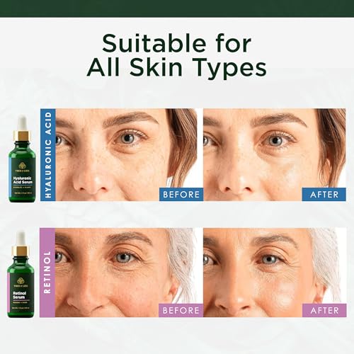Image of Tree of Life Face Serum Skin Care Set, Hyaluronic Acid & Retinol Serum