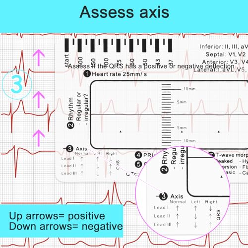 ECG 7 Step Ruler, Portable ECG Assessment Tool ECG/EKG 7 Step Ruler Card for ECG/EKG Interpretation ECG Ruler Plastic Ruler Measuring Tool ECG EKG Card Ruler ECG Reference Guide with Protect Sheath